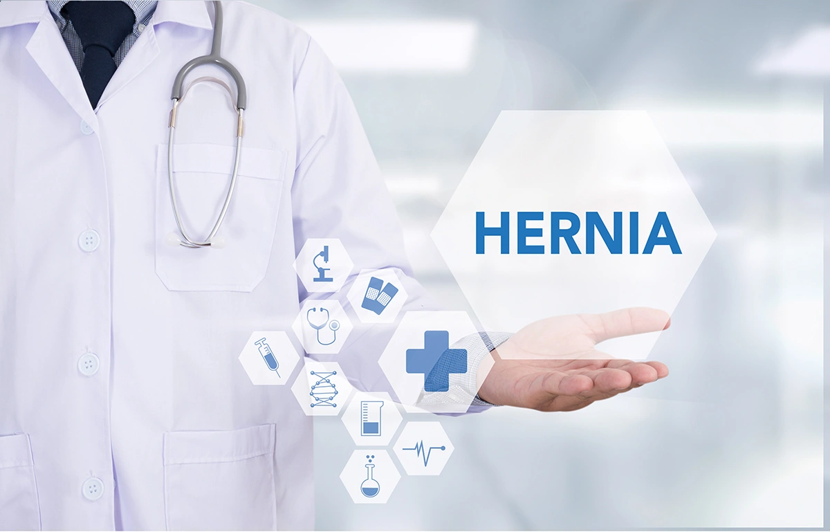 Conceptual image of a hernia specialist